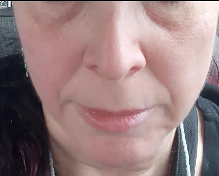 Radio Frequency Skin Tightening Device, Smart Electric Zinc Alloy Facial Beauty Machine with RF-Current Cold Heat for Jawline Lifting, Cheek Firm, Wrinkle Reduction, Depuff, Increase Absorption customer photo 2