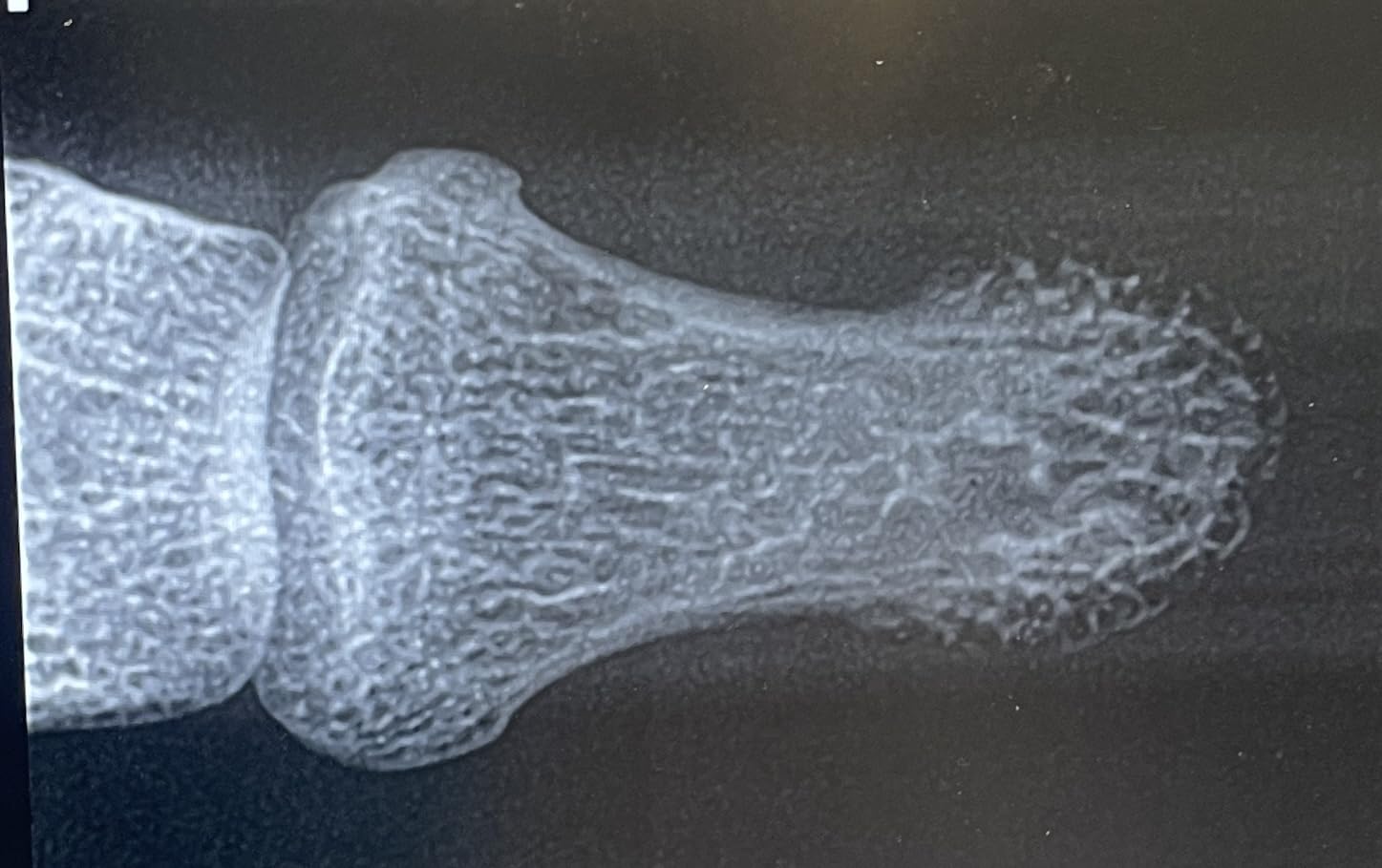 Dental X-Ray Sensor Veterinary Radiovisograph HD Digital Intraoral Imaging System Portable X Ray Digital Sensor (1.5 (25x30mm)) customer photo 2