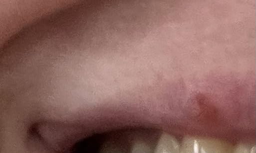 Infrared Red Light Therapy Device for Joints & Muscles Pain Relief, 460:630:660:850:900nm Cold Sore Canker Fever Treat, Portable Near Infrared Wand customer photo 1