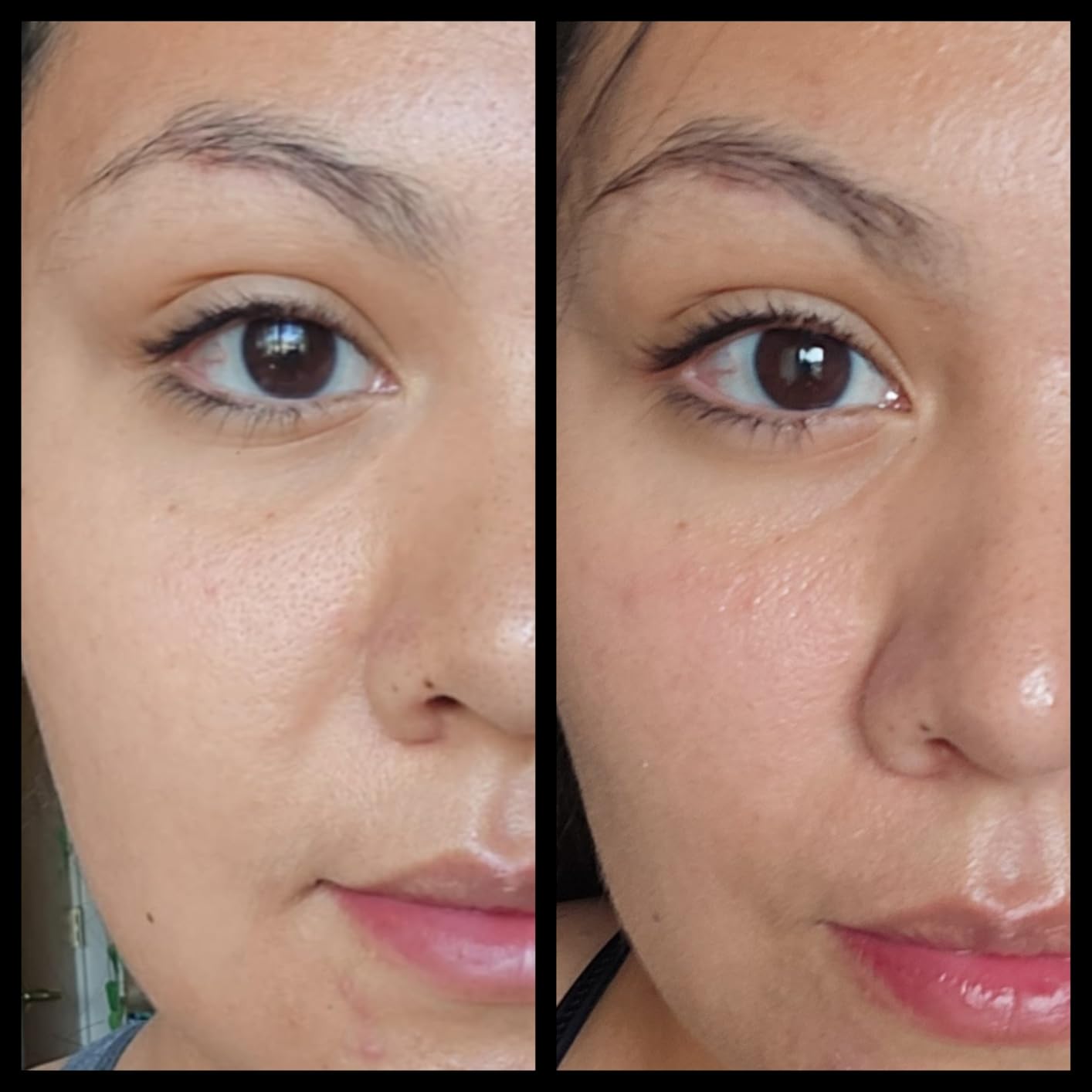 L'Oreal Paris Revitalift Triple Power Anti-Aging Eye Cream, Pro Retinol, Hyaluronic Acid & Vitamin C, Reduce Wrinkles & Puffiness 0.5 fl. oz customer photo 2