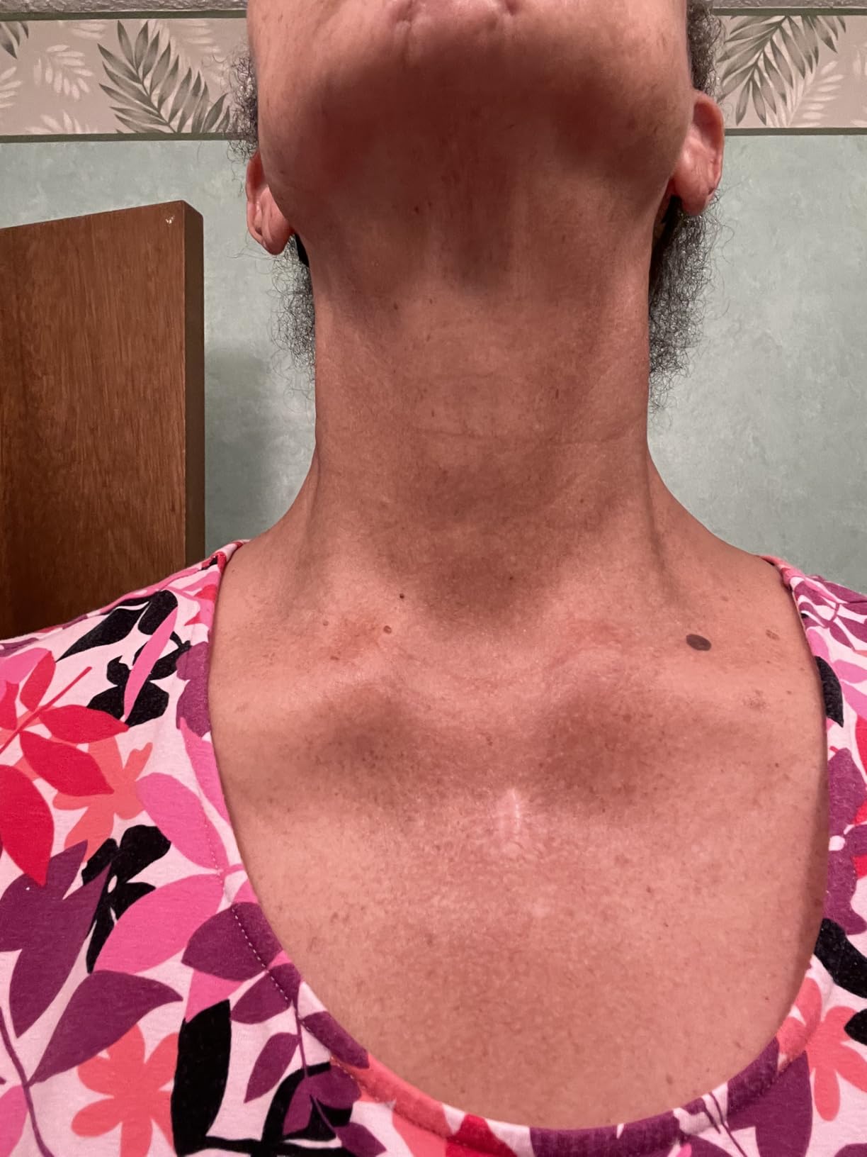 Advanced Clinicals Retinol Body Lotion & Face Moisturizer | Visible Anti Aging Skin Care Retinol Body Cream For Women & Men Targets Look Of Fine Lines, Wrinkles, & Crepe Looking Dry Skin, 16 Ounce customer photo 2
