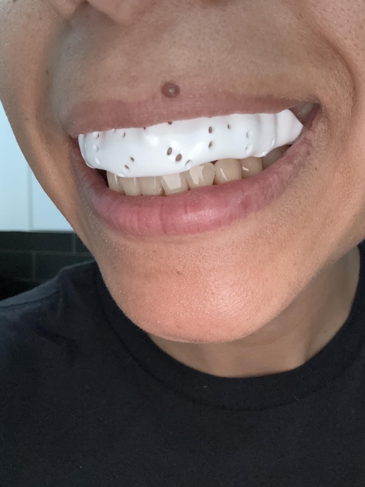 SISU Aero Medium Mouthguard, Snow White - 30% Stronger Protection for Lacrosse, Football, Hockey, Roller Derby, Team Sports - Remoldable Up to 20 Times - Ultra Slim - Works for Braces - Non Toxic customer photo 2
