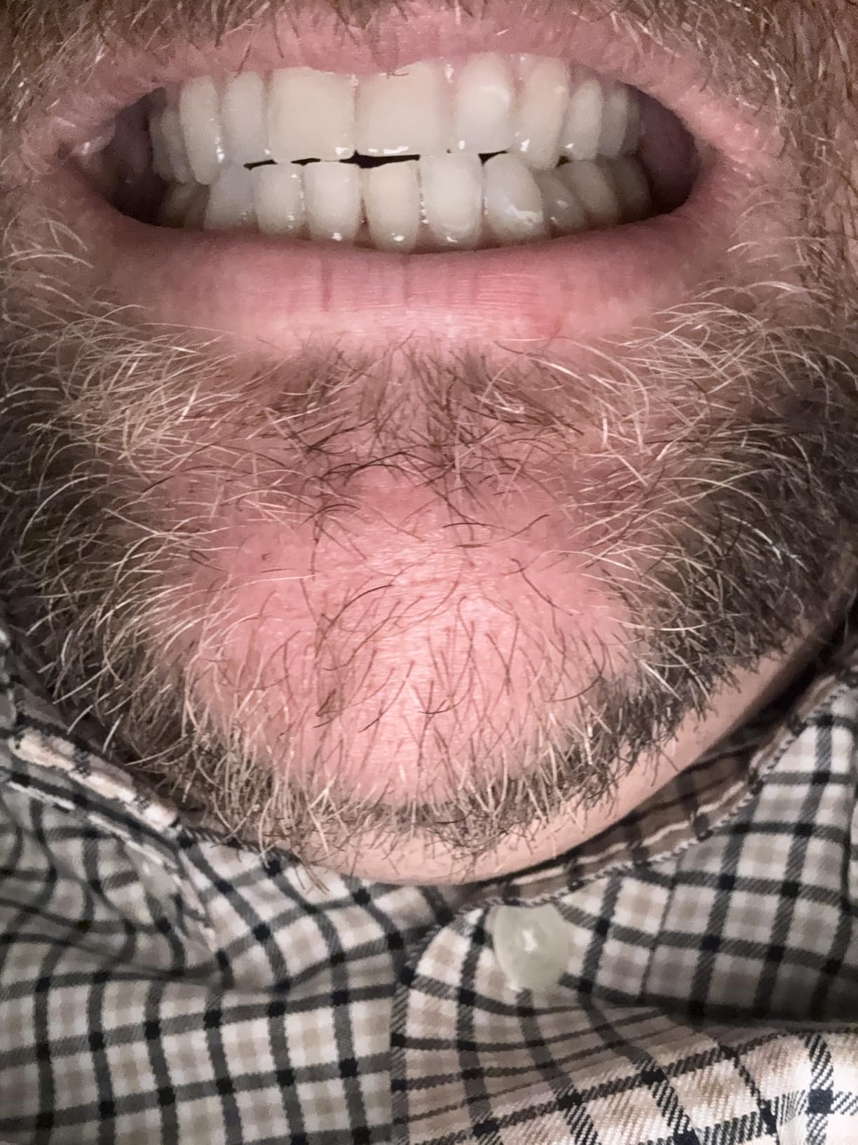 Crest 3D Whitestrips Age Renewal Teeth Whitening Kit, 24 Treatments (48 Strips) customer photo 2