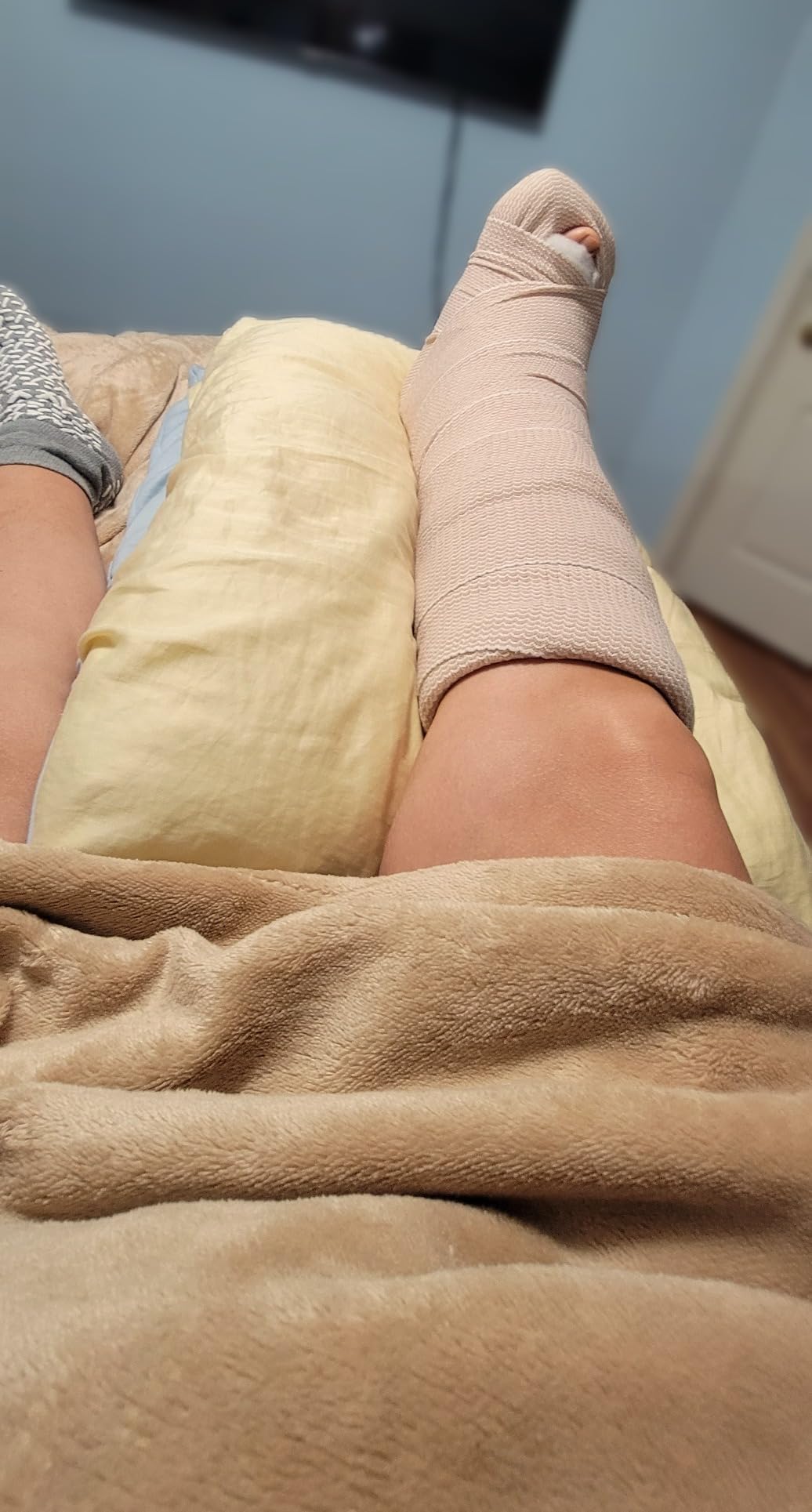 Kolbs Double Leg Elevation Pillow | Post Surgery Leg Pillow | Stylish Chic Jacquard Cover customer photo 2