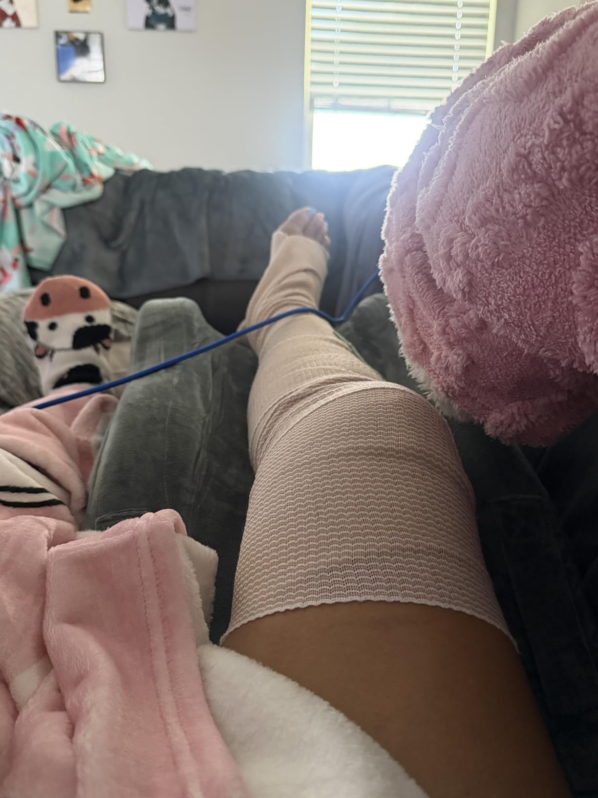 KingPavonini Adjustable Leg Elevation Pillows for After Surgery, Ergonomic Curve Keeps Knee Straight, Memory Foam Leg Pillow Elevation for Blood Circulation, Swelling and Pain Relief (Single Leg) customer photo 1