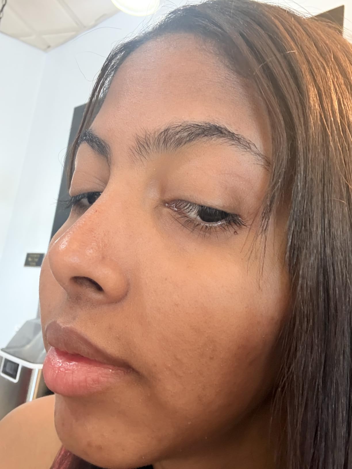 EltaMD UV Clear Face Sunscreen SPF 46, Oil-Free Sunscreen with Zinc Oxide, Dermatologist Recommended customer photo 2