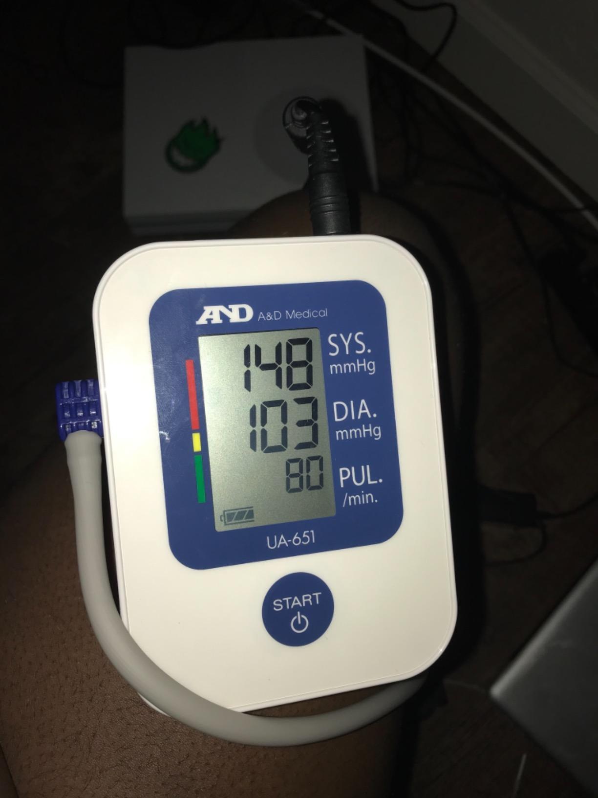 A&D Medical UA-651 Upper Arm Blood Pressure Monitor, Cuff 8.6-16.5