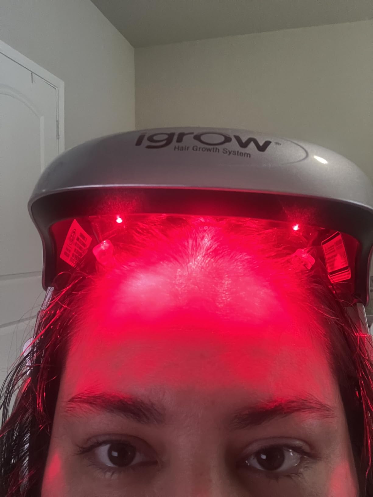 iGrow Laser Hair Growth System - Red Light Helmet Therapy, Clinically Proven, FDA Cleared Laser Cap Hair Growth for Men & Women customer photo 2