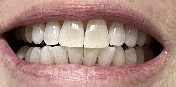 Crest 3D Whitestrips Express Whitening with Light, Whitestrips 3D White, Teeth Whitening Strip Kit, 20 Strips (10 Count Pack), Crest Teeth Whitening Strips, Teeth Whitening Kit customer photo 2