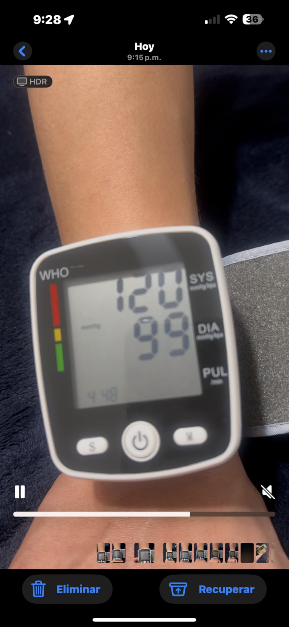 FDA Cleared Blood Pressure Monitor Wrist BP Machine for Home Use | 5.3-7.7in Adjustable Wrist Cuff, Portable & Rechargeable, 2 Users *90 Memory, LCD Screen, Voice Prompt, Carrying Case, Black customer photo 1