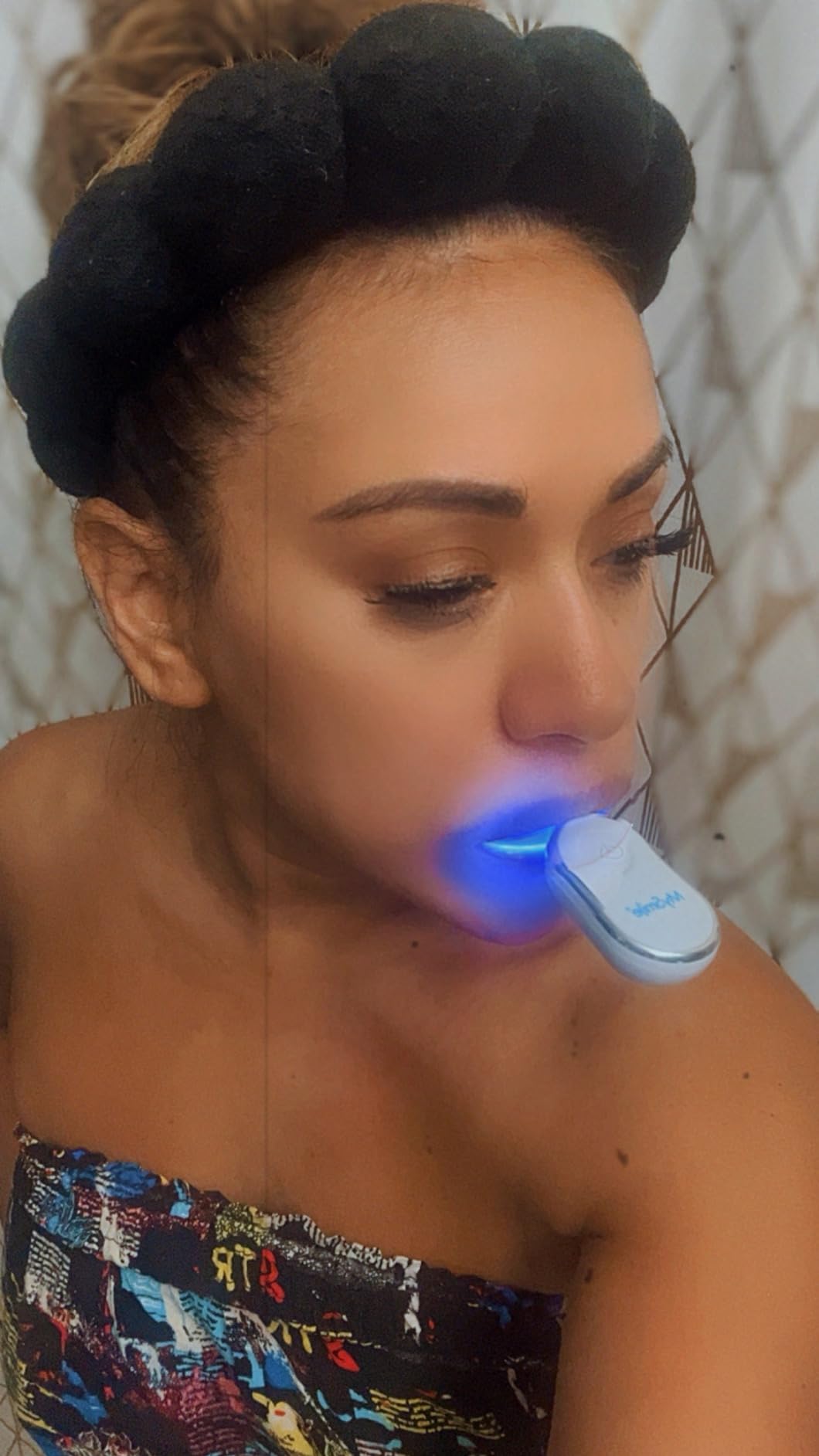 MySmile Teeth Whitening Kit for Sensitive Teeth, 30+ Treatments Whitener | 4*3ml 35% Carbamide Peroxide Whitening Gel+4ml Remineralization Pen & 28LED Whitening Tray Light, Remove Years of Stains customer photo 1