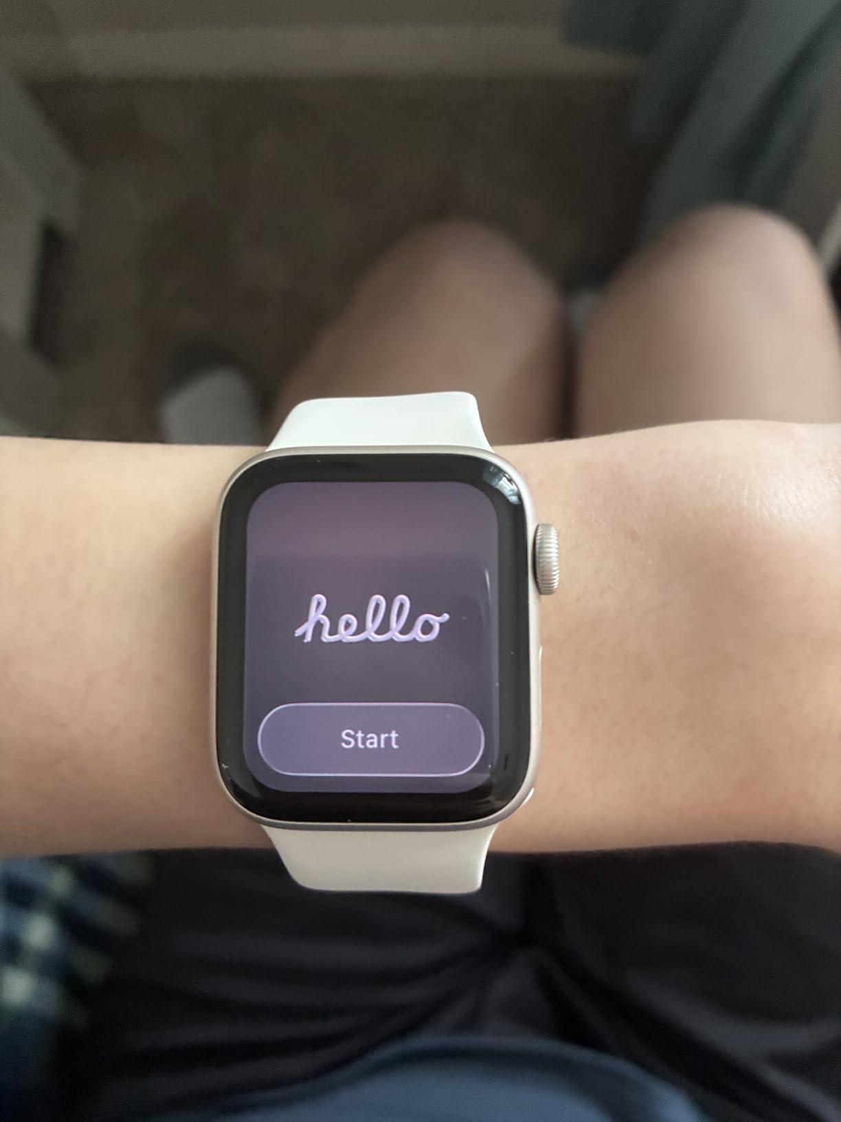 Apple Watch SE 3 GPS 40mm Smartwatch customer photo 2