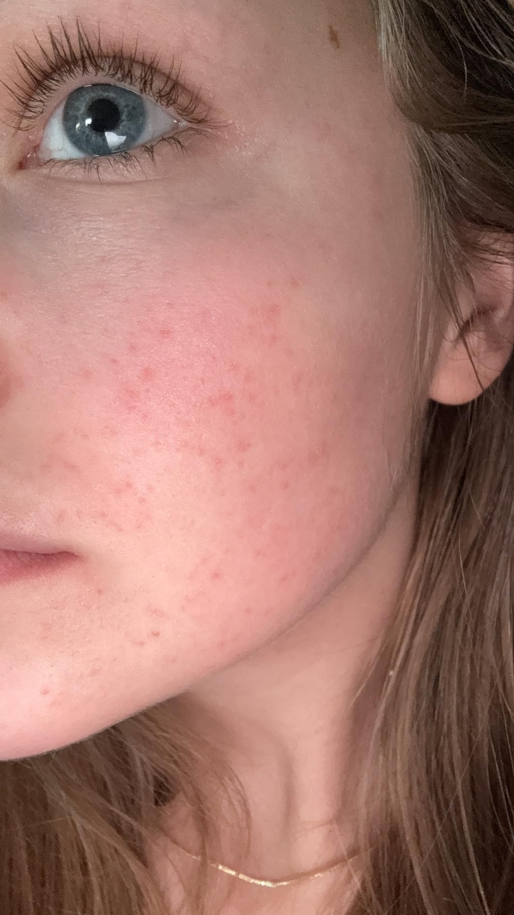 The Derma Co 1% Hyaluronic Sunscreen Aqua Gel with SPF 50 & PA++++ | Broad Spectrum UVA/B & Blue Light Protection | Lightweight & Quick Absorbing with Vitamin E | 1.76 Oz/50g customer photo 1